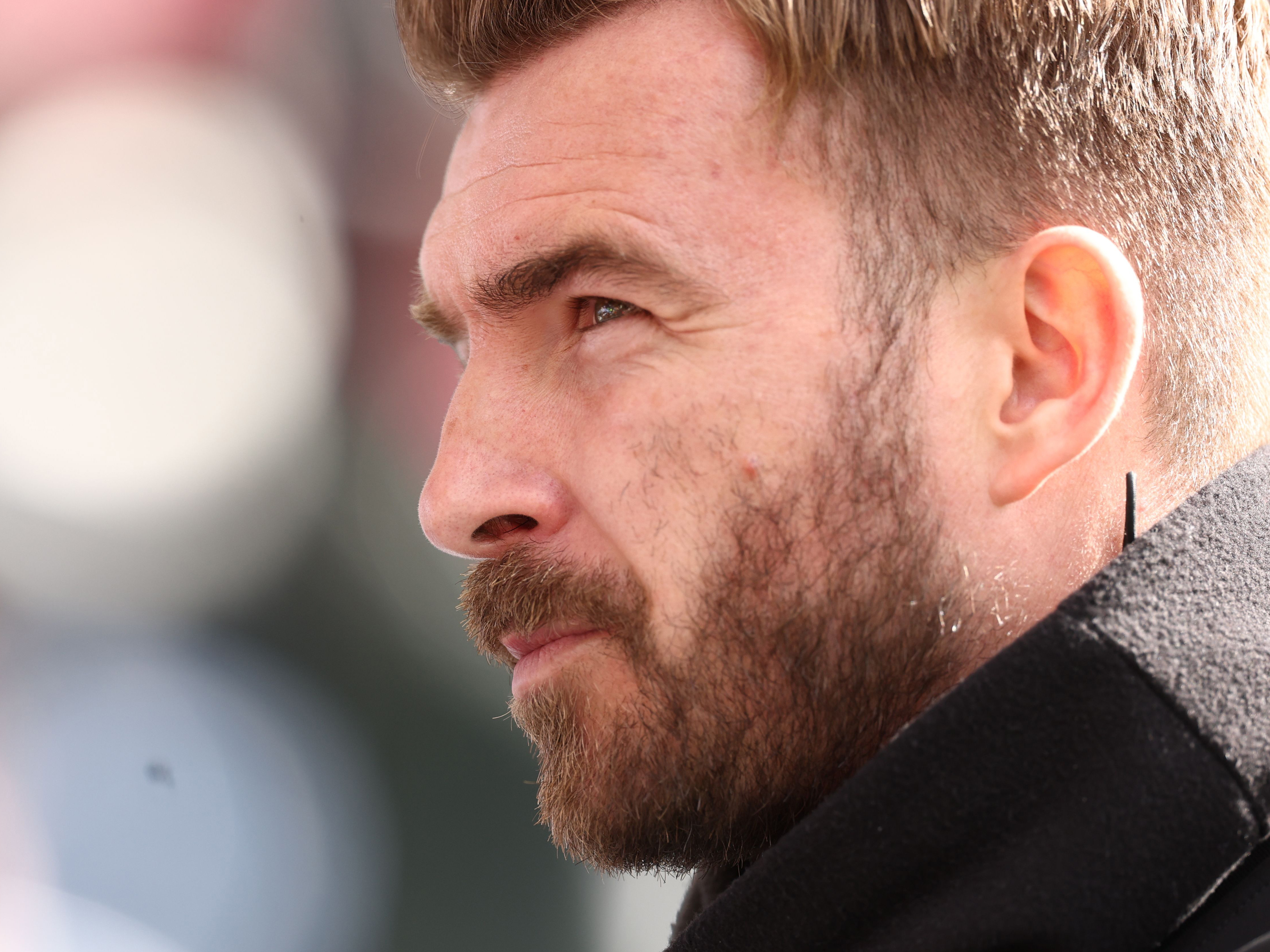 A close up of the side of James Morrison's face 